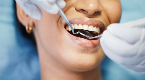 Best Emergency Root Canal Treatment in East Lexington, VA