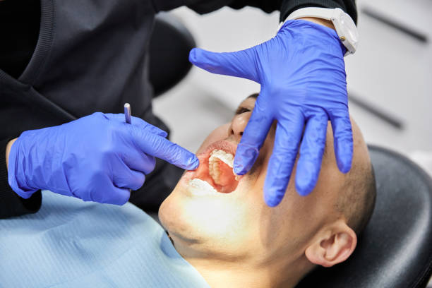 Best Same-Day Emergency Dental Services in East Lexington, VA